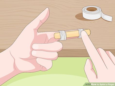 3 Ways to Splint a Finger - wikiHow Diy Thumb Splint, Diy Finger Splint, Broken Finger Splint, Fractured Finger, Jammed Finger, Thumb Splint, Finger Injury, Advanced Cardiac Life Support, Broken Finger