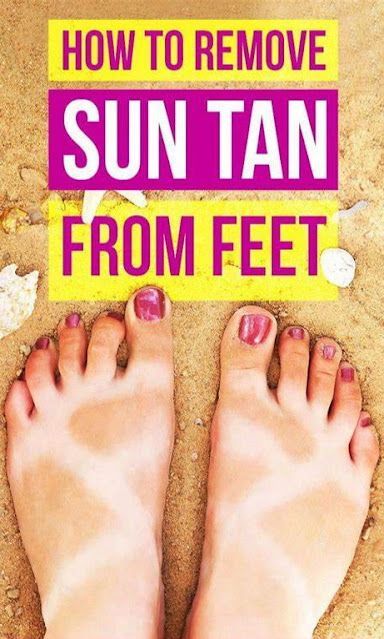 How To Remove Sun Tan From Feet Tan Removal Home Remedies, Feet Whitening, Get Rid Of Tan, Sun Tan Removal, Hands Care, Upper Lip Hair, Aloe Vera Face Mask, How To Get Tan, Acne Skincare