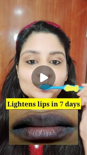 How To Get Rid Of Dark Lips Remedies, How To Remove Dark Lips, Lip Darkness Removal, Lip Scrub Diy For Dark Lips, How To Get Rid Of Dark Lips, Dark Lips Remedy, Two Toned Lips, Tan Removal Remedies, Remedies For Dark Lips