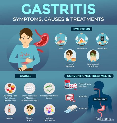 Gastritis: Symptoms, Causes, and Support Strategies - DrJockers.com Ulcer Symptoms, Gastric Problem, Reflux Diet, Gastrointestinal Disease, Acid Reflux Diet, Stomach Ulcers, Stomach Issues, Stomach Pain, After Life