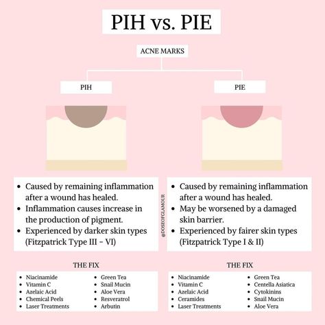 Do you know the difference between Post-Inflammatory Hyperpigmentation (PIH) and Post-Inflammatory Erythema (PIE)? Knowing the difference… Post Inflammatory Erythema, Glowing Skin Routine, Post Inflammatory Hyperpigmentation, Bad Acne, Mary Kay Skin Care, Face Care Routine, Sephora Skin Care, Inflammation Causes, Skin Care Cream