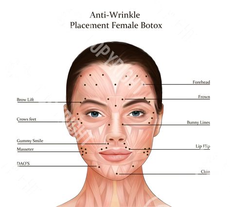 Botox Lip Flip, Botox Injection Sites, Injection Sites, Lip Flip, Botox Injection, Botox Before And After, Botox Filler, Muscles Of The Face, Botox Lips