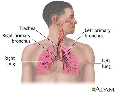 respiratory system Respiratory System Anatomy, Chest Infection, Homemade Products, Lung Disease, Holistic Remedies, Shortness Of Breath, Respiratory System, Essential Oils Rosemary, Anatomy And Physiology