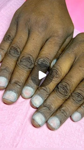 How To Get Rid Of Finger Wrinkles, Face Home Remedies Skincare, How To Get Fair Hands, Dark Knuckles Cream, How To Get Rid Of Dark Knuckles On Hands, How To Get Rid Of Hand Wrinkles, How To Get Rid Of Wrinkles On Hands, Dark Knuckles Remedies, How To Get Rid Of Dark Knuckles