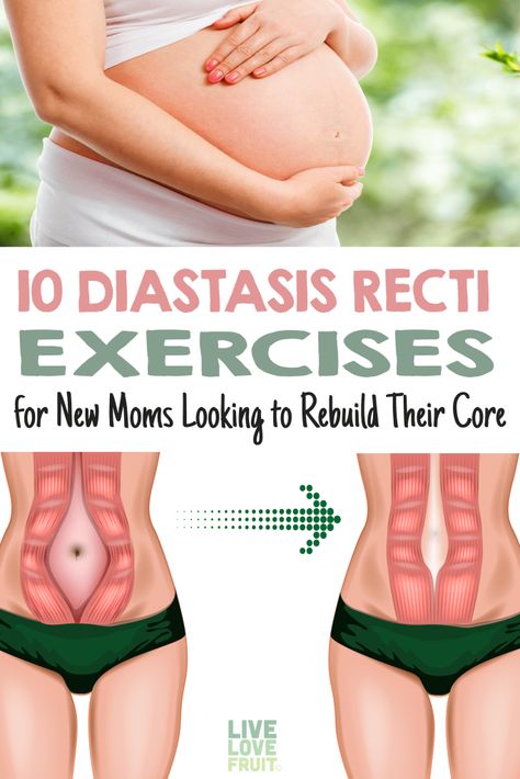 Diástase Abdominal, Pregnant Tips, Post Baby Workout, Diastasis Recti Exercises, Post Pregnancy Workout, Baby Workout, Pumping Moms, Diastasis Recti, Yoga Exercises