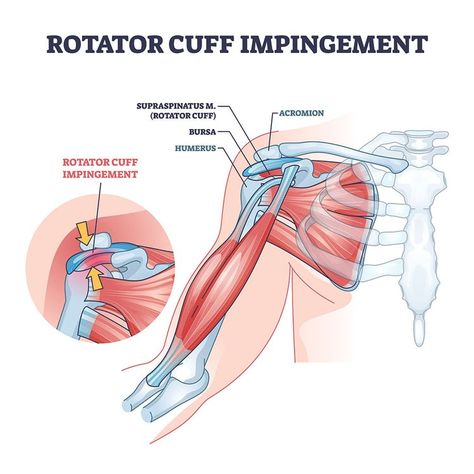 Sartorius Muscle, Shoulder Muscle, Shoulder Impingement, Trigger Point Therapy, Frozen Shoulder, Trigger Point, Science Notes, It Band, Rotator Cuff