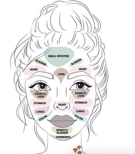 Wondering if there is a connection between acne and each organ in your body? There is! ✨- map of acne on face - face acne map - face acne chart - face acne meaning - map of acne on face - skincare routine - skincare tips - #skincare #acne Face Acne Remedies, Acne Chart, Best Acne Scar Removal, Face Map, Skin Mapping, Face Acne Treatment, Jade Face Roller, Facial Massage Roller, Face Skin Care Routine