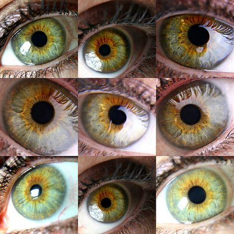 Central heterochromia is the uneven distribution of pigment in the eye, a genetic mutation. I've often wished I had Heterochromia iridum (eyes of two different colors) but, this is just as cool, I think. Those pictures are just about how my eyes look. Eye Color Facts, Central Heterochromia, Heterochromia Eyes, Rare Eye Colors, Hazel Green Eyes, Eye Color Chart, Rare Eyes, Different Colored Eyes, True Autumn