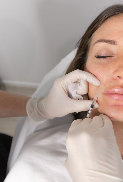 Lips Filler Aesthetic, Beauty Injections Aesthetic, Botox Aesthetic Photography, Botox Inspiration, Botox Photoshoot, Doctors Office Aesthetic, Deep Nasolabial, Armonizacion Facial, Injection Aesthetic