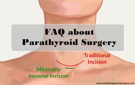 Parathyroid Surgery, Thyroid Surgery, Gallbladder Surgery, Laparoscopic Surgery, General Surgery, Liquid Diet, Surgery Recovery, Body Scanning, Thyroid Health