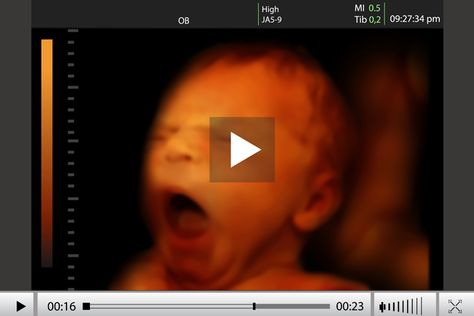 What is A 4D Ultrasound Scan 4d Ultrasound Pictures, 3d Ultrasound Pictures, Gender Reveal Ultrasound, Baby Bedside Sleeper, 3d Ultrasound, 4d Ultrasound, Baby Ultrasound, Ultrasound Pictures, Baby Scan