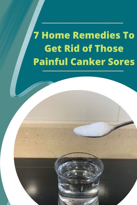 Are canker sores killing you? These are the most simple and effective home remedies you can try. They will relieve your pain and help your sores heal. Canker Sore Remedies, Canker Sore Remedy, Canker Sore, Simple Home, Nutrition Advice, Health And Nutrition, Home Remedies, Nutrition, Let Me