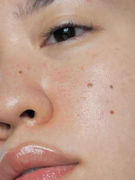 Skin Conditions Photography, Real Skin Photoshoot, Skin Zoomed In, Skin Close Up Texture, Skin Texture Aesthetic, Skin Close Up, Skin Texture Photography, Imperfections Photography, Skin Up Close