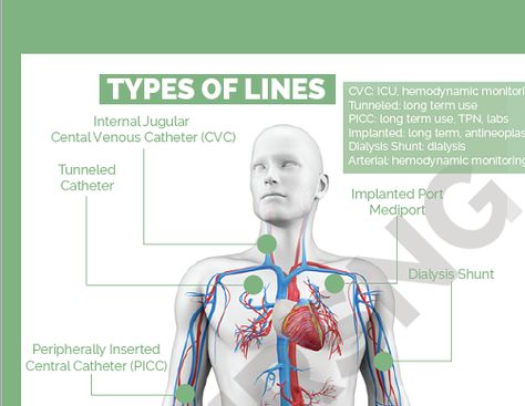 Central Lines Nursing, Central Venous Catheter Nursing, Parenteral Nutrition, Central Venous Pressure, Central Venous Catheter, Nurse Study, Types Of Lines, Central Line, Nurse Study Notes