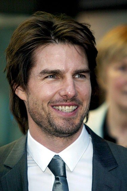 Adult Braces, Dental Kids, Teeth Braces, Cheryl Cole, Six Month, Healthy Smile, Tom Cruise, Famous Faces, Dental Health