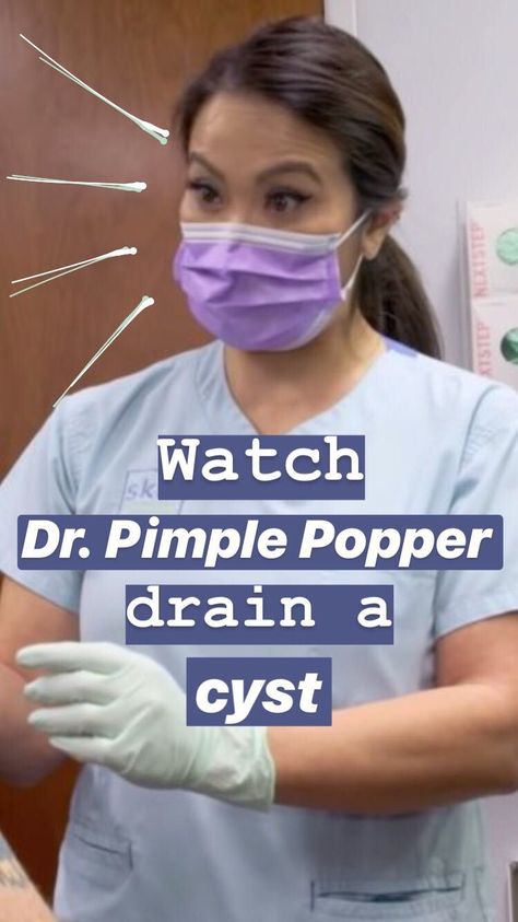 Watch Dr. Pimple Popper drain a bloody cyst that reminded her of Shamu the whale Head Pimples, Pimple Popper Videos Black Heads, Pimple Popper Tool, Cystic Pimple, Homecoming Makeup Browneyes, Losing 40 Pounds, Makeup Looks For Brown Eyes, The Whale, Skincare Video