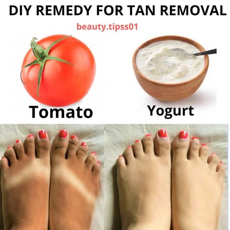 Tan Removal Home Remedies, Natural Skin Care Remedies, Tan Removal, Natural Face Skin Care, Dry Skin Remedies, Diy Skin Care Recipes, Skin Care Face Mask, Organic Remedy, Perfect Skin Care Routine