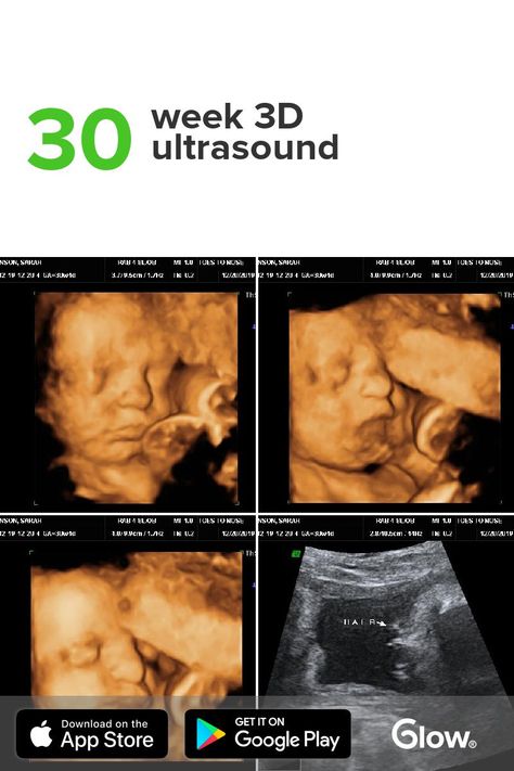 30 Week Ultrasound, Boy Ultrasound Pictures, 3d Ultrasound Pictures, 10 Weeks Pregnant Ultrasound, 11 Weeks Pregnant Ultrasound, Boy Ultrasound, 3 Weeks Pregnant Ultrasound, Conceiving A Girl, 8 Weeks Pregnant Ultrasound