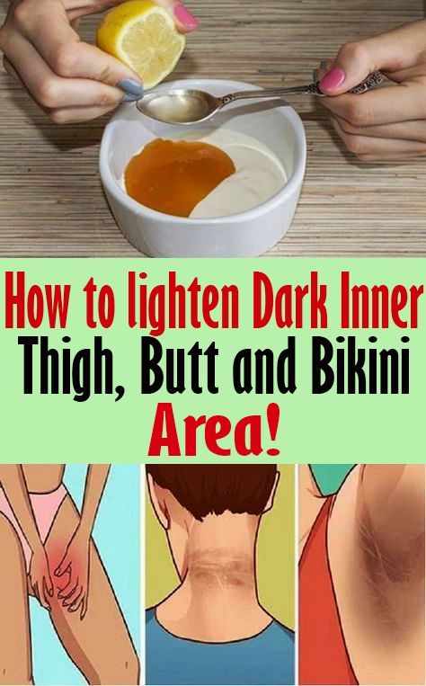 How to Lighten Dark Inner Thighs, Butt and Bikini Area! Dark Inner Thighs, Dark Armpits, Dark Underarms, Health Planner, Healthy Routine, Inner Thigh, Health Facts, Health Remedies, Natural Remedies