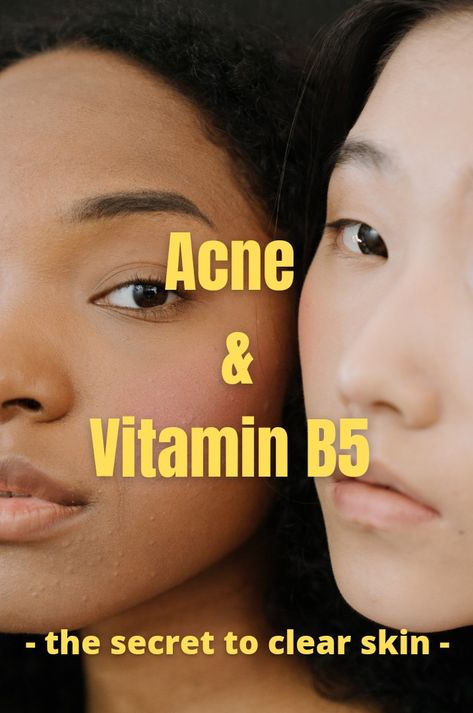 Vitamin For Acne Clear Skin, Clyndamiacin For Acne, Best Vitamins For Acne, Vitamins For Hormonal Acne, Vitamins For Acne Clear Skin, Face Acne Remedies, Supplements For Acne, Best Acne Scar Removal, Face Acne Treatment