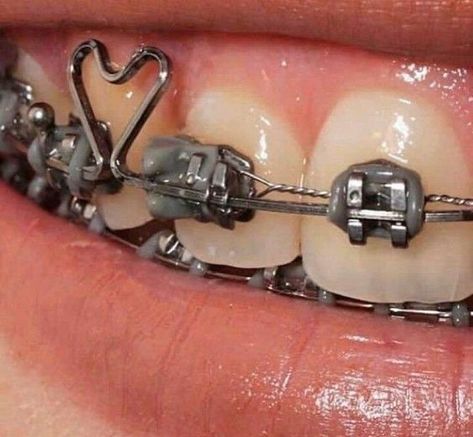 Teeth Aesthetic, Cute Braces Colors, Dental World, Getting Braces, Braces Girls, Orthodontic Appliances, Cute Braces, Bright Eye Makeup, Brace Face