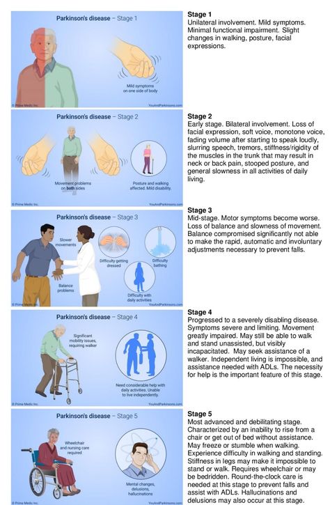 Parkinson's disease - Pass The OT Nbcot Exam Prep, Nbcot Exam, Occupational Therapy Schools, Parkinsons Awareness, Occupational Therapy Assistant, Exam Prep, Neurology, Occupational Therapy, Cheat Sheet