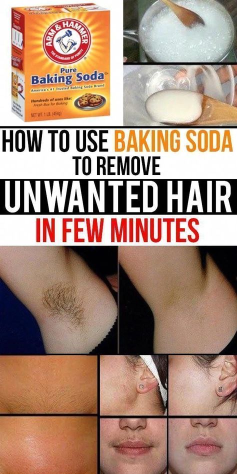 Unwanted Hair Removal Methods You Can Try at Home #HomeRemediesforUnwantedHair #UnwantedHairRemovalWithLaser #ChinHairRemoval #LegHairRemoval Best Permanent Hair Removal, Chin Hair Removal, Permanent Facial Hair Removal, Back Hair Removal, Electrolysis Hair Removal, Lip Hair Removal, Ingrown Hair Removal, Best Hair Removal Products, Remove Unwanted Facial Hair