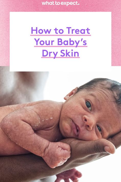 Newborn Skin Peeling, Newborn Dry Skin, Baby Dry Skin, Dry Legs, Thick Moisturizer, Flaking Skin, Dry Flaky Skin, Dry Skin On Face, Dry Skin Remedies