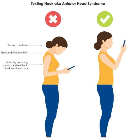 Ways To Fix Posture, How To Fix Sway Back Posture, Fix Forward Head Posture, Forward Head Posture Correction Exercise, How To Fix Poor Posture, Posture Stretches, Chin Tuck, Forward Head Posture Exercises, Referred Pain