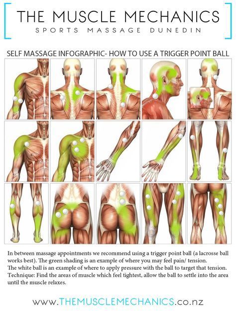 Neck Tension, Remedial Massage, Massage Envy, Massage Therapy Techniques, Wellness Selfcare, Back Pain Remedies, Trigger Point, Sports Massage, Massage Benefits