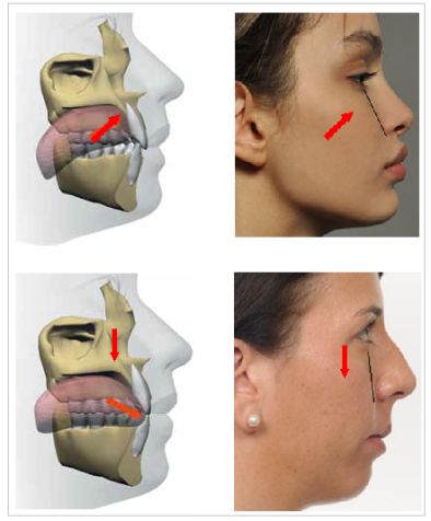 Punkty Spustowe, Jaw Exercises, Jawline Exercise, Facial Bones, Face Anatomy, Crooked Teeth, Facial Aesthetics, Tongue Health, Face Exercises