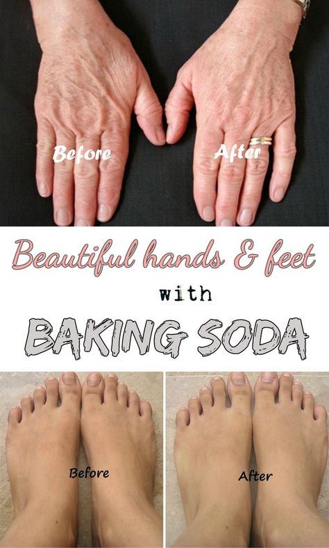 Baking soda is one of those household items that have traditionally been considered to be a necessity. This common kitchen ingredient can not only be used for baking, but  also do wonders for the skin on your hand and feet.  In these cold winter months, skin is normally more susceptible to drying and cracking. Although Baking Soda Scrub, Baking Soda For Hair, Baking Soda Water, Face Scrub Homemade, Baking Soda Uses, Baking Soda Shampoo, Beauty Remedies, Hand Care, Homemade Beauty Products