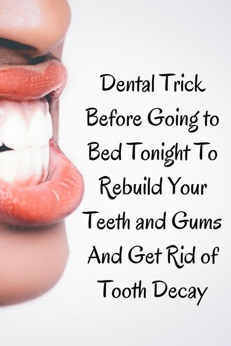 Simple 20 Second Trick Turns Back Years Of Tooth Decay.Do This 60 Seconds Dental Trick Before Going to Bed Tonight To Rebuild Your Teeth and Gums.Click the link and watch the full video.#toothdecay #toothproblem #WhatAreOralCare #WhatIsOralCare #HowToCareForOralHealth #WhyOralCareIsImportantForElderly #OralDentalCare#dentist Fix Teeth, Teeth Remedies, Reverse Cavities, Pasta Dental, Teeth Health, Stronger Teeth, Oral Care Routine, Receding Gums, Before Going To Bed