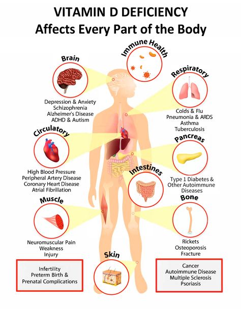 Interactive PDF: How Vitamin D Deficiency Affects Every Part of the Body - GrassrootsHealth Skin Bumps, Vitamin D Supplement, Vitamin D Deficiency, Vitamin Supplements, The Human Body, Autoimmune Disease, Vitamin D, Vitamins And Minerals, Personal Trainer