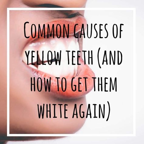 Common Causes of Yellow Teeth (and How to Get Them White Again!) Discolored Teeth, Yellow Teeth, Coconut Oil Pulling, Oil Pulling, White Smile, School Communication, Creating A Newsletter, Perfect Smile, I Feel Pretty