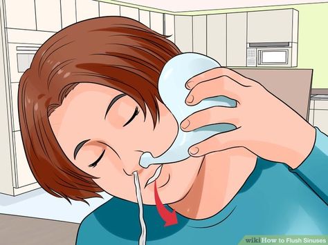 Sinus Rinse Recipe, Sinus Flush, Remedy For Sinus Congestion, Sinus Drainage, Home Remedies For Sinus, Nasal Wash, Sinus Congestion Relief, Sinus Cavities, Advanced Cardiac Life Support