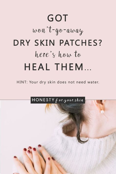 Dry skin patches are oh so irritating... especially when they happen on your face. They look flaky, red and can be sensitive. They can suck your confidence. Clump your foundation. Be painful, itchy and ageing. Dry skin patches are a sign your skin health is low. Do nothing and your dry skin patches will get worse. Choose to take action and your skin health battery can be happily topped back to full. Want to know how? Come learn all my friend... Flaky Skin On Face, Patchy Skin, Dry Flaky Skin, Dry Skin On Face, Skin Balm, Dry Skin Remedies, Skin Patches, Dry Skin Patches, Dry Face