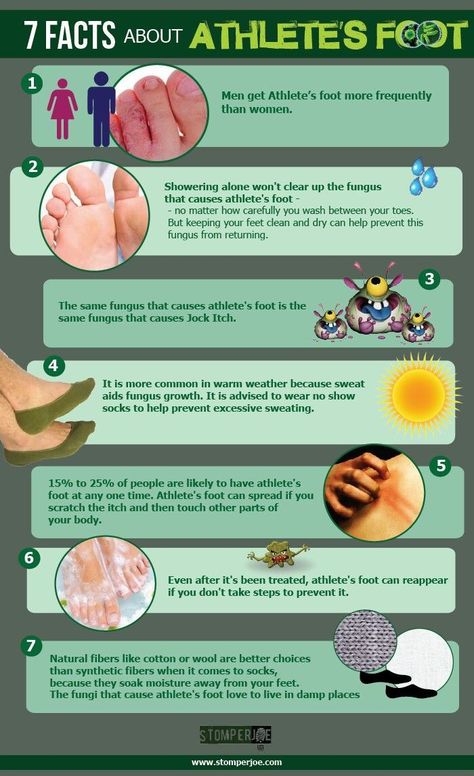 Nail Infection Nail Remedies, Athletes Foot, Nails Today, Fungal Infection, Nail Health, Health Check, Healthy Nails, Digestion Problems, Medical Prescription