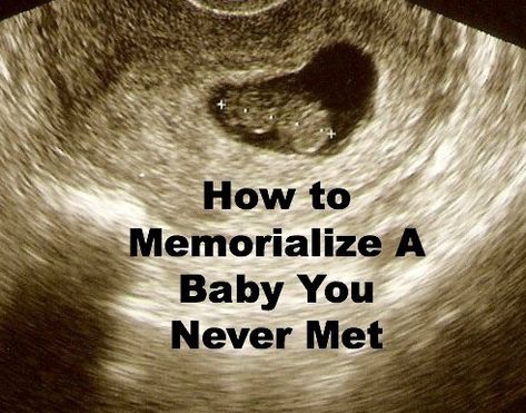 If you're looking for a way to memorialize a baby you never met, this post provides a really neat idea. A beautiful way to remember a miscarried baby. Remembering Baby, Angel Baby Quotes, Baby Memorial Tattoos, Baby Remembrance, Losing A Baby, Unborn Baby, Pregnancy Loss, Baby Tattoos, Infant Loss