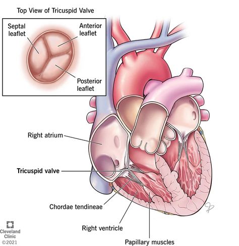 Enlarged Liver, Tricuspid Valve, Heart Valves, Heart Defect, Heart Healthy Diet, Heart Pump, Heart Function, Heart Muscle, Body Fluid