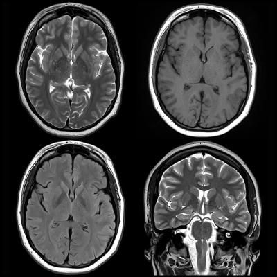 Brain Scan Neuroscience, Mri Scans Aesthetic, Mri Scan Aesthetic, Fmri Scans, Ct Scan Brain, Brain Mri Scan, Anatomy Embroidery, Brain Mri, Depersonalization Disorder