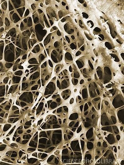 Human bone in close-up Cancellous Bone, Motifs Organiques, Foto Macro, Scanning Electron Micrograph, Microscopic Photography, Natural Structures, Science Photos, Natural Forms, Patterns In Nature