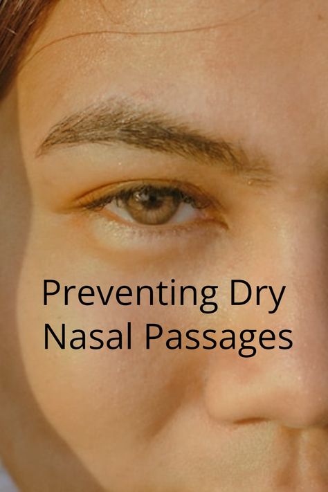 You could avoid things that trigger your dry nose such as dust. But this is not a simple task. However, you can make it a point to get areas that collect more in your home. Less exposure to dust will make your nose happy. Dry Nose Remedy, Dry Sinuses, Remedy For Sinus Congestion, Remedies For Dry Mouth, Home Remedies For Sinus, Blocked Nose, Natural Remedies For Migraines, Dry Nose, Nose Bleeds