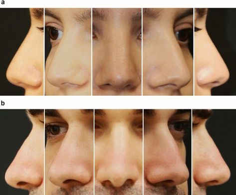 Nose All Angles, Flat Nose Reference, Covering Ears Reference, Face Anatomy Tips, 360 Face Reference, Noses From The Side, Nose Reference Angles, Roman Nose Front View, Noses Different Angles