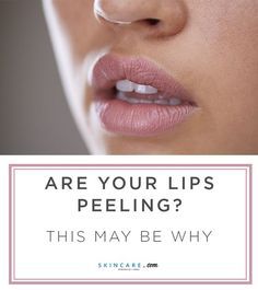 From what causes our lips to peel in the first place to how we can prevent this from happening we're sharing expert tips for achieving smooth lips. #beauty #makeup #skincare #lipcare Dry Skin Causes, Lips Peeling, Pale Lips, Medical Esthetician, Dry Cracked Lips, Cream For Oily Skin, Dry Skin Body, Best Lip Balm, Cracked Lips