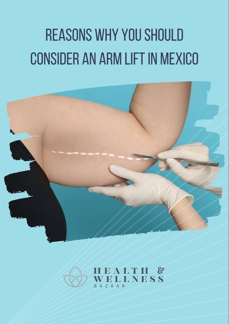 Don’t you like the look and shape of your arms? Do you think they are too thick and undefined? Currently, countless patients seek to reshape the appearance of their arms after losing a lot of weight or for genetic reasons through an arm lift in Mexico since this will allow them to eliminate excess skin and achieve the slim beautiful arms they have always wanted. #aesthetic #bodycare #surgeryclinic Excess Skin Removal Surgery, Arm Lift Surgery Before And After, Wanted Aesthetic, Under Arm Fat, Arm Lift Surgery, Skin Removal Surgery, Arm Flab, Beautiful Arms, Arm Lift