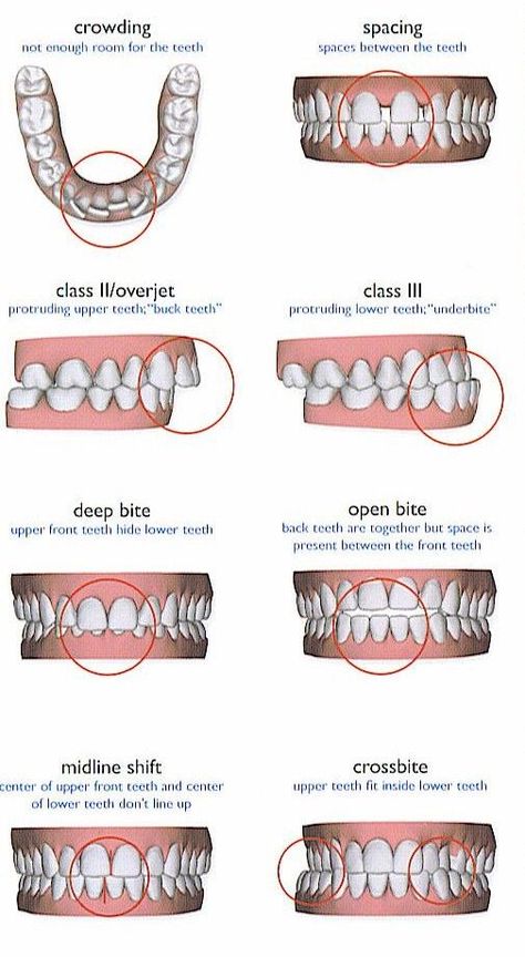 Dental Assistant Study Guide, Dental Assistant School, Dental Hygienist School, Dental Assistant Study, Dental Hygiene Student, Dental Videos, Kedokteran Gigi, Kesehatan Gigi, Dental Hygiene School