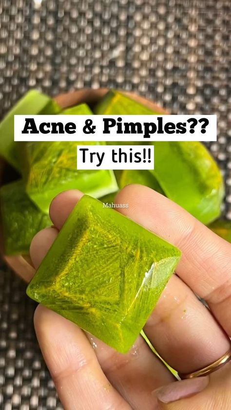 Relief from acne & pimples in 2022 | Healthy skin tips, Money life hacks, Acne and pimples Natural Skin Care Ingredients, Face Skin Care Routine, Pimples Remedies, Clear Healthy Skin, Natural Skin Care Remedies, Diy Skin Care Routine, Good Skin Tips, Diy Skin Care Recipes, Face Pack