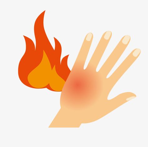 Hand Burns Skin, Burn Care, Chemical Burn, Burn Injury, Images Cartoon, Degree Burns, Burning Body, Hand Clipart, Health Words