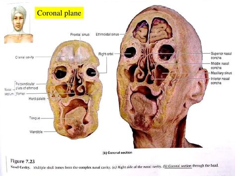 cadaver coronal sinus head - Ecosia - Images Cross Section, Human Anatomy, Renewable Energy, The Search, Trees To Plant, Search Engine, Anatomy, Art Inspiration, Medical